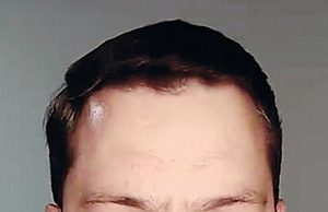 Com coronavírus, Marcos Neves cumpre isolamento em casa