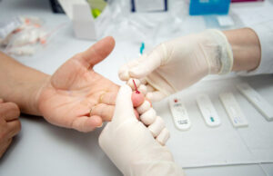 Saúde de Osasco promove testagem de Hepatites B e Cem pessoas acima dos 20 anos